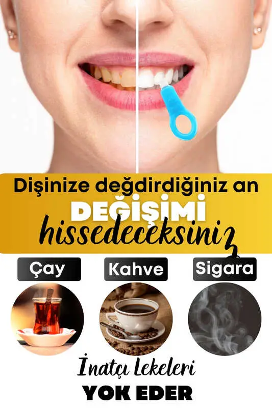 Diş  Siisi 1 Aparatlı + 5 Yedek Süngerli Set 1 Paket 3